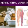 sciatica-karan-lakshan-upchar-aur-bachav